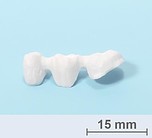 3-gliedrige Brückenkonstruktion aus HiPer&reg;-DENT-Z-Zirkonoxid